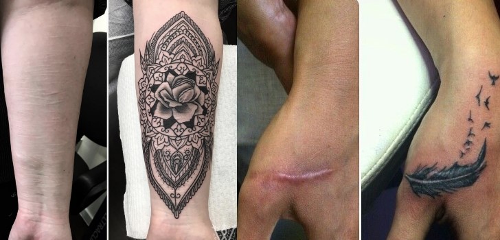 Tatuagens Para Esconder Cicatrizes