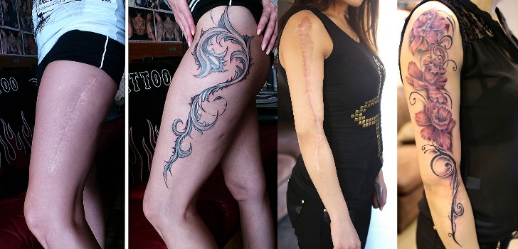 tatuagens-para-cobrir-cicatrizes5