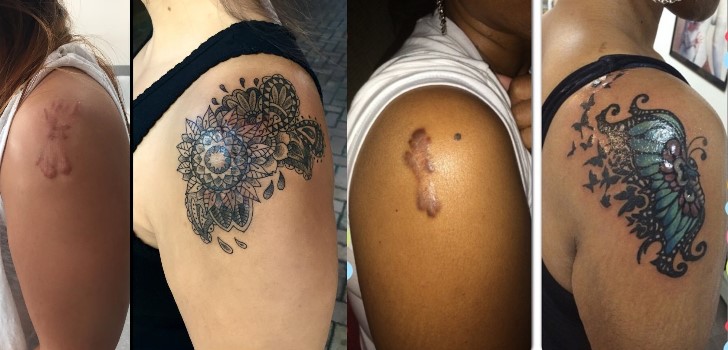 tatuagens-para-cobrir-cicatrizes6