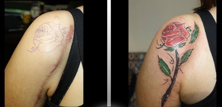 tatuagens-para-cobrir-cicatrizes9