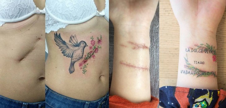 Tatuagens sobre cicatrizes